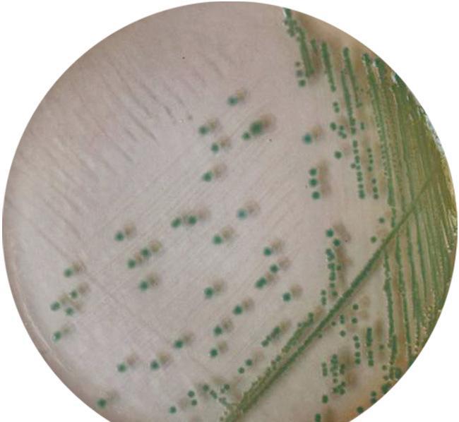 无锡优质显色培养基哪里有出售--宜兴市永信生物有限公司