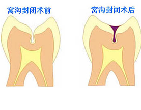 牙齿修复中心