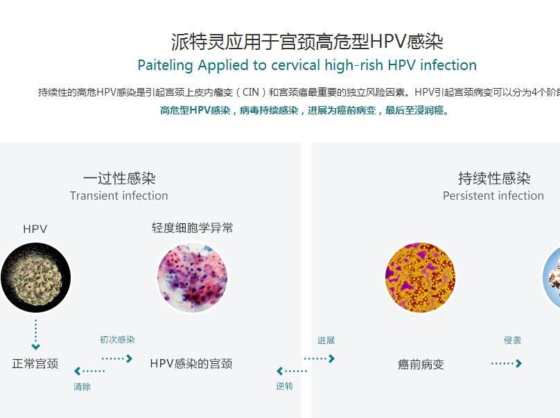 派特灵洁尔和派特灵是一个产品么？有什么区别？